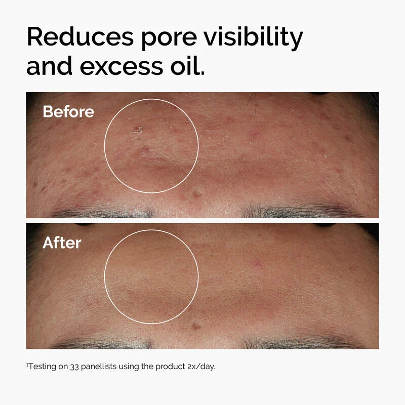 100% Original Niacinamide 10% + Zinc 1% Serum